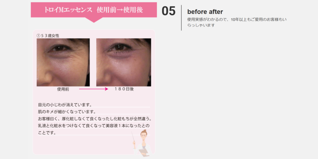 トロイMエッセンス